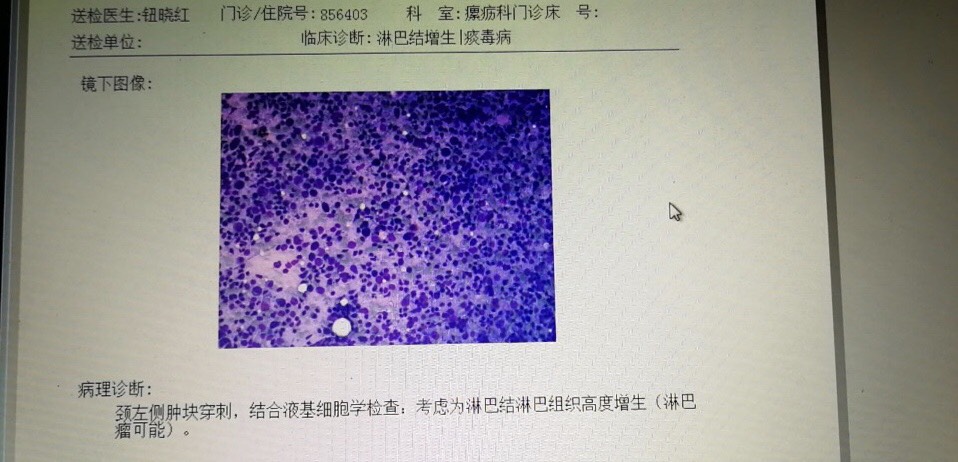 181355c6iq4zssptmqp4qx.jpg