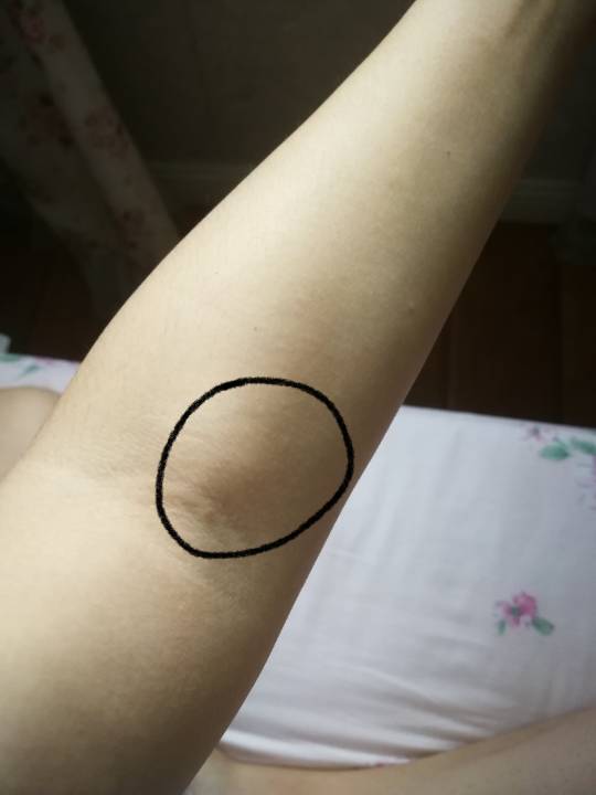 手肘内侧有淋巴结吗