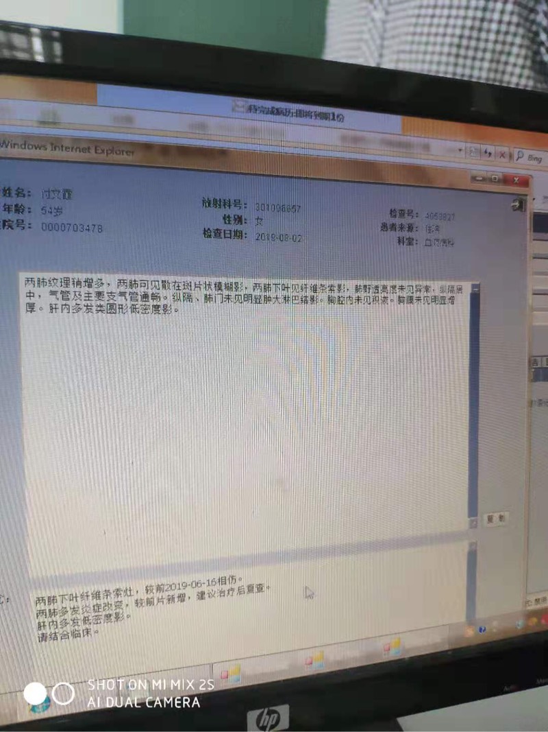 010656gmdxi4zqlqznxbcl.jpg