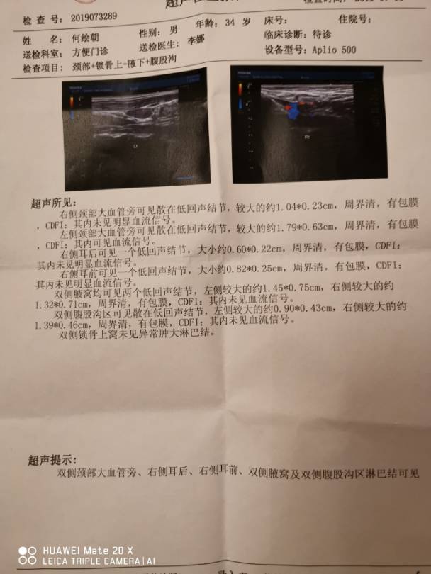 173929astq5wjgtccssist.jpg