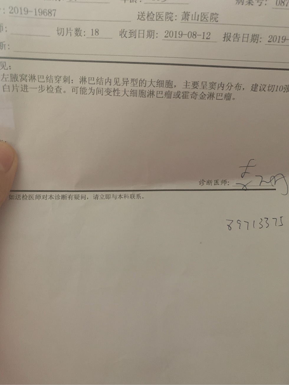 124222je1ebhpx8lzpkypk.jpg