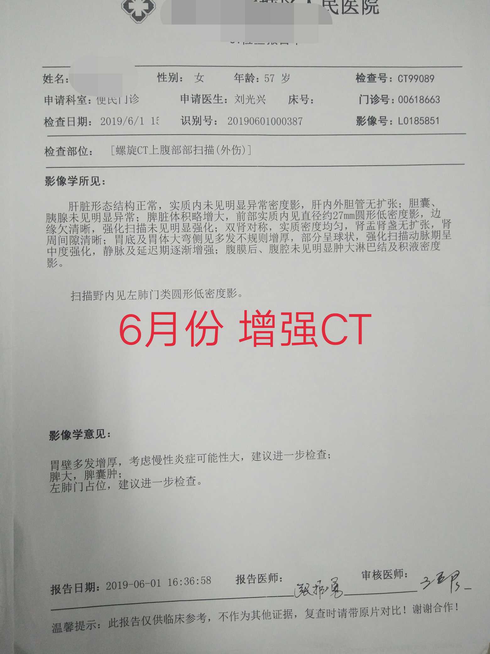 142224hlw7sceazepmfesu.JPG