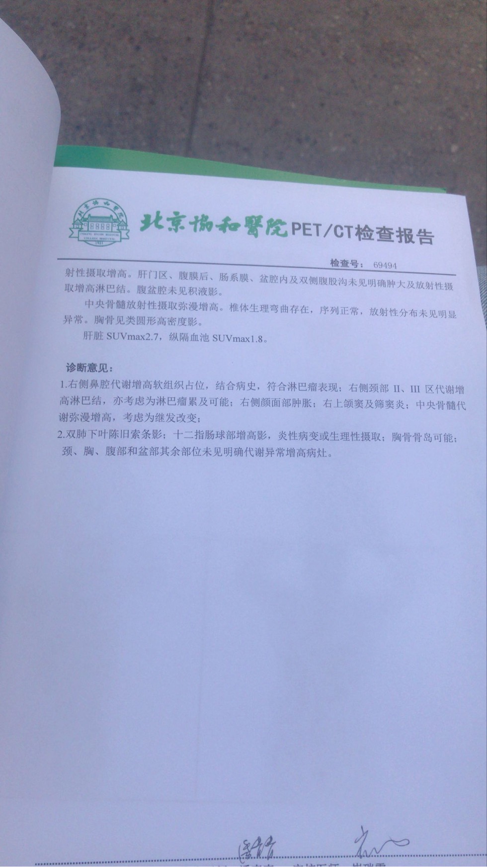 161220pyw00kc6gmfpcwcc.jpg