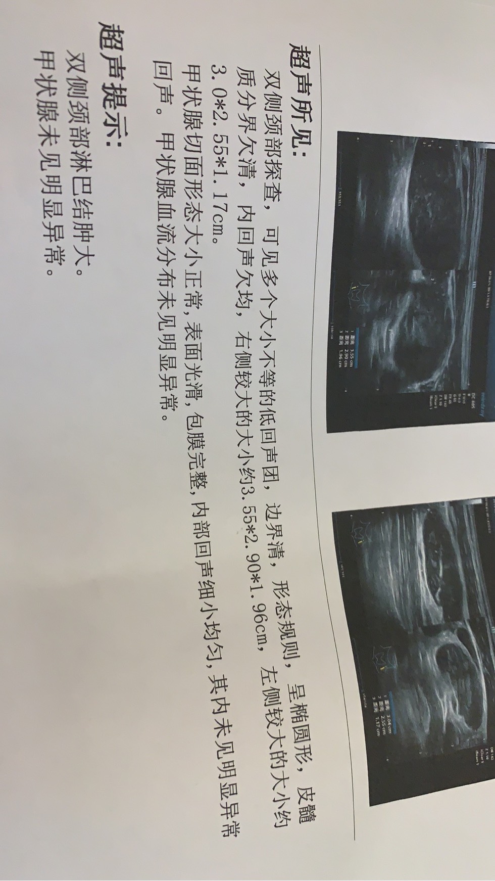 222037lfs9859fu44fkh8s.jpg