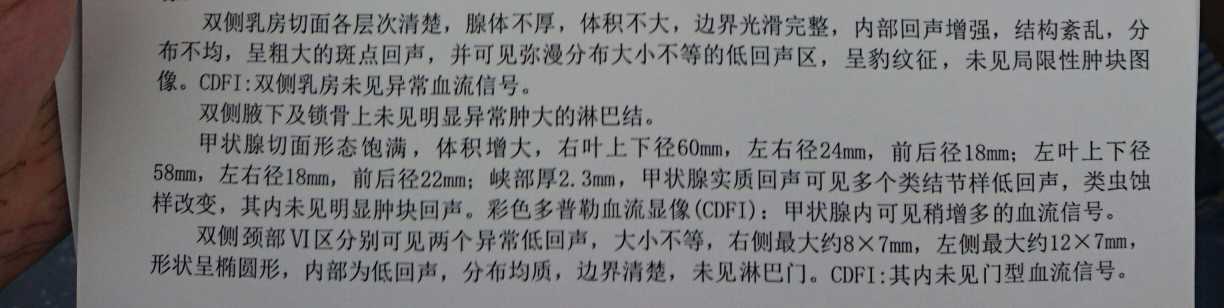 150453wq44ywbx77ib97q9.jpeg