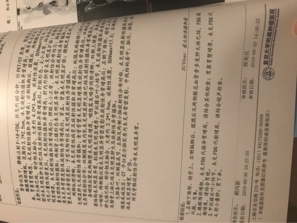 225740jsfmk08bkhhsmozx.jpg