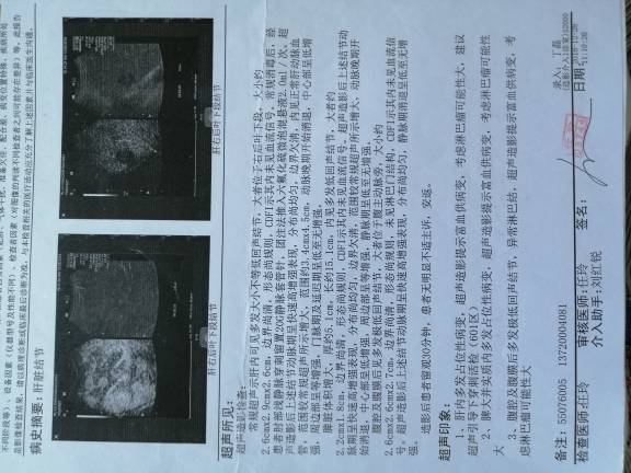 121312q4xxl868eh11ji00.jpg