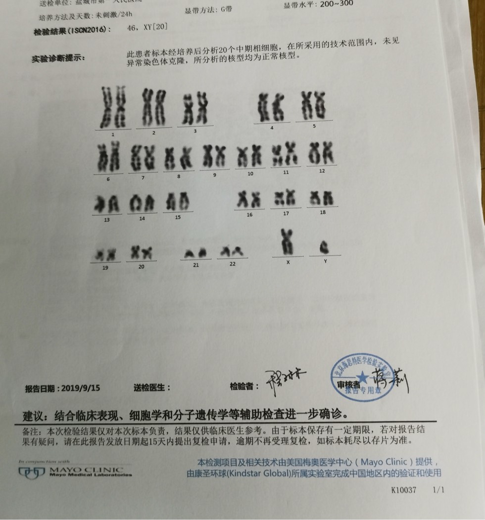 160303ia9catapt6y76pvv.jpg