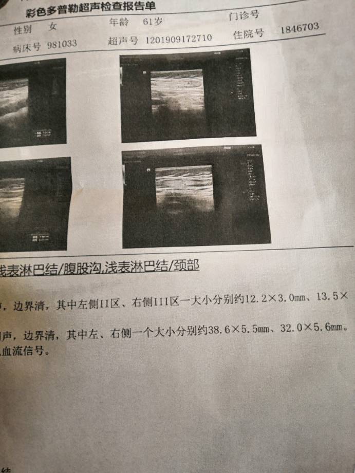 203444n5sj3gs5hzlge4fz.jpg