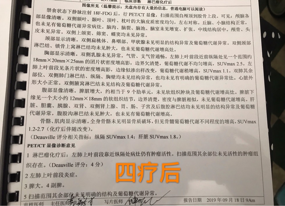 001545lypywg33ngznseun.jpg