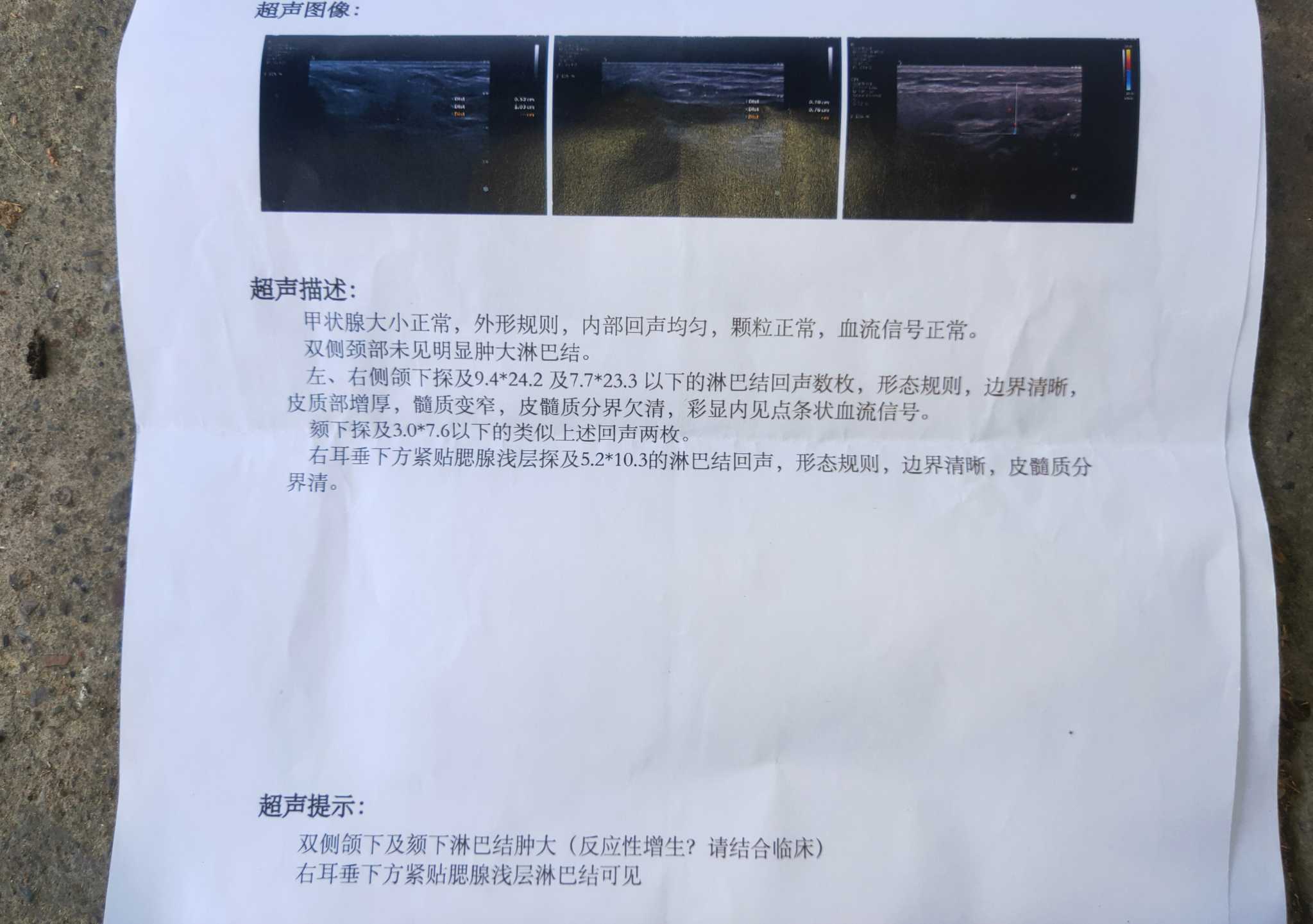 173525tvtckng33neqcv6k.jpg