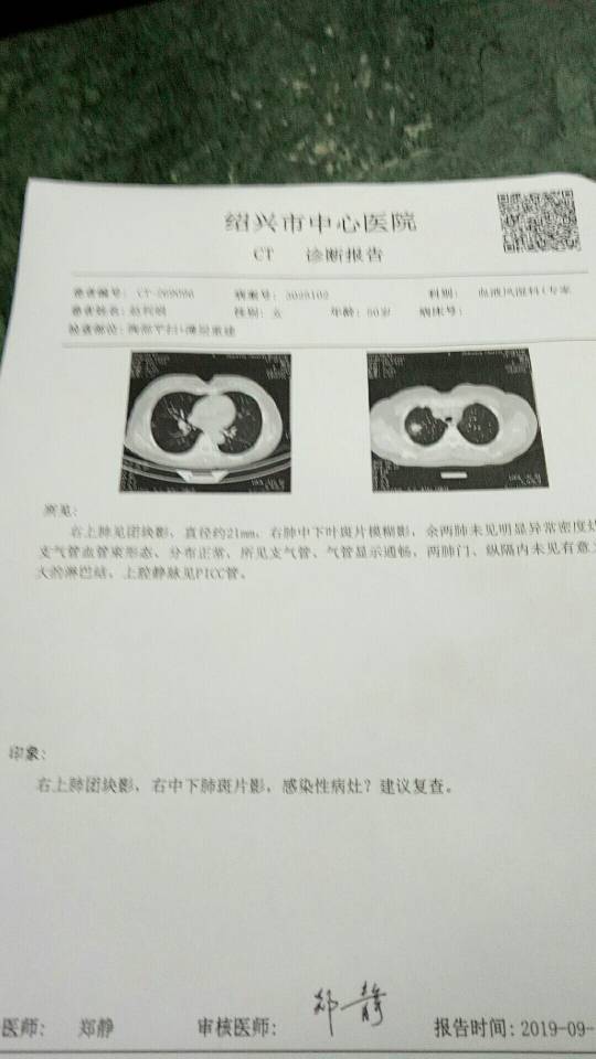 221919ghmgj00ic999ublz.jpg