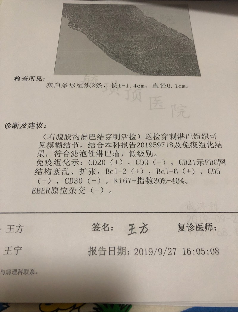 160739j4vktb49ut76uob8.jpg