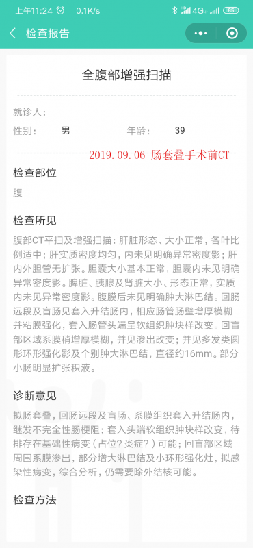 手术前CT