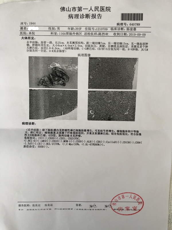 佛市一病理诊断