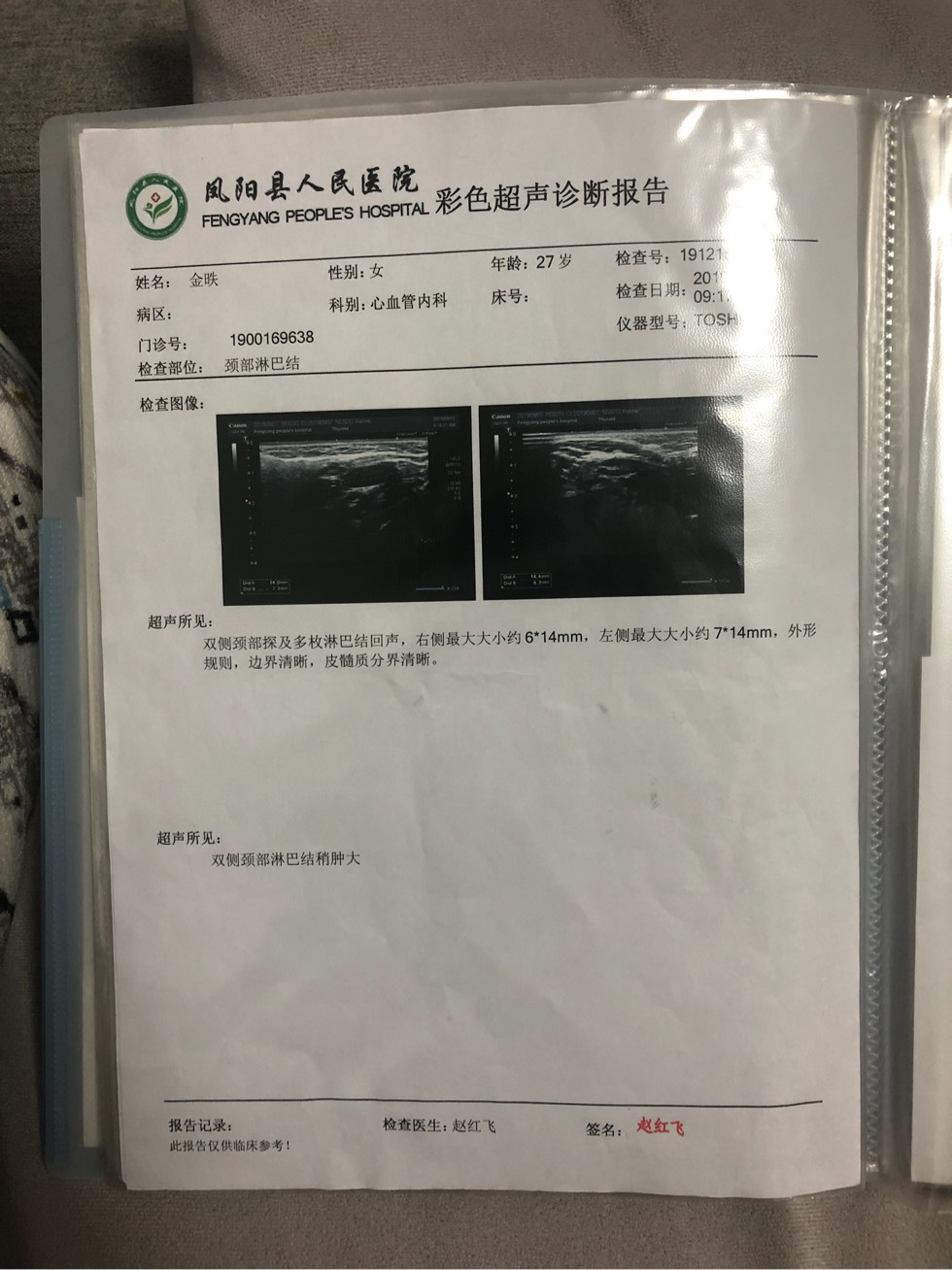 172808hru7b7ccukzrc7rh.jpg