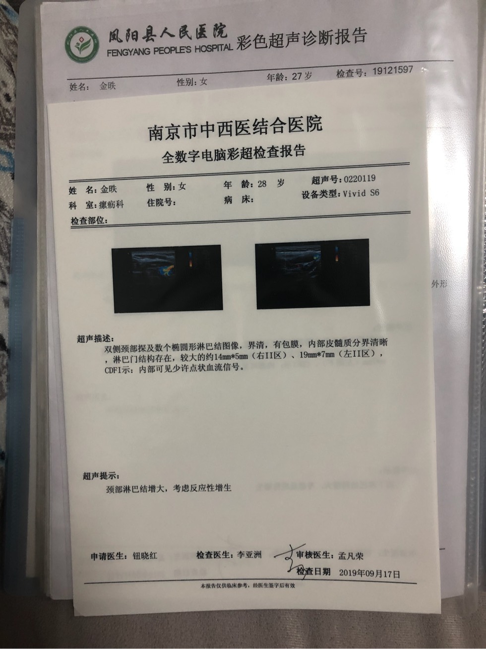 172810uisrl2b5imqsimr2.jpg