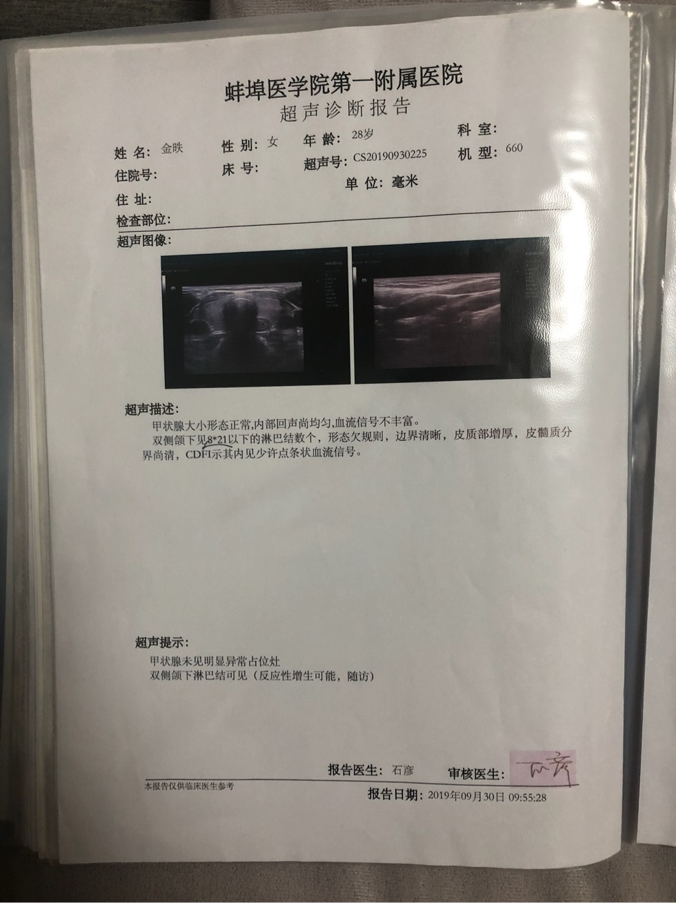 172811kizfs5iu3ykj00qv.jpg
