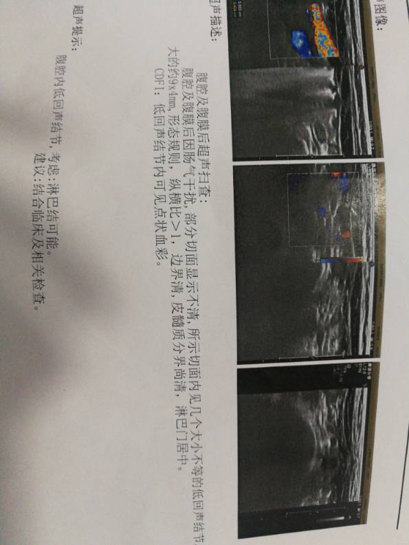 151739bn3mpd58sgpoeeee.jpg