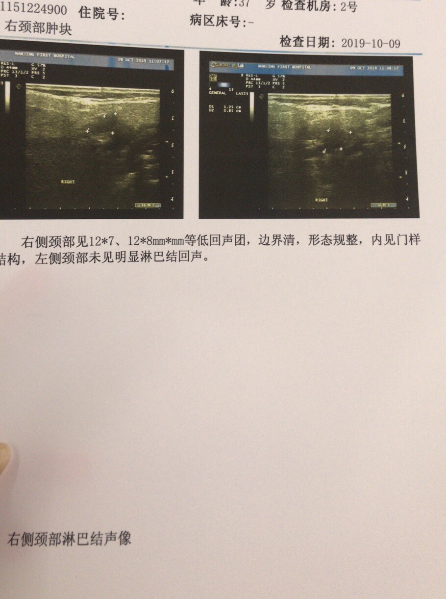 211621ukn2o00oh7qyf0qn.jpg