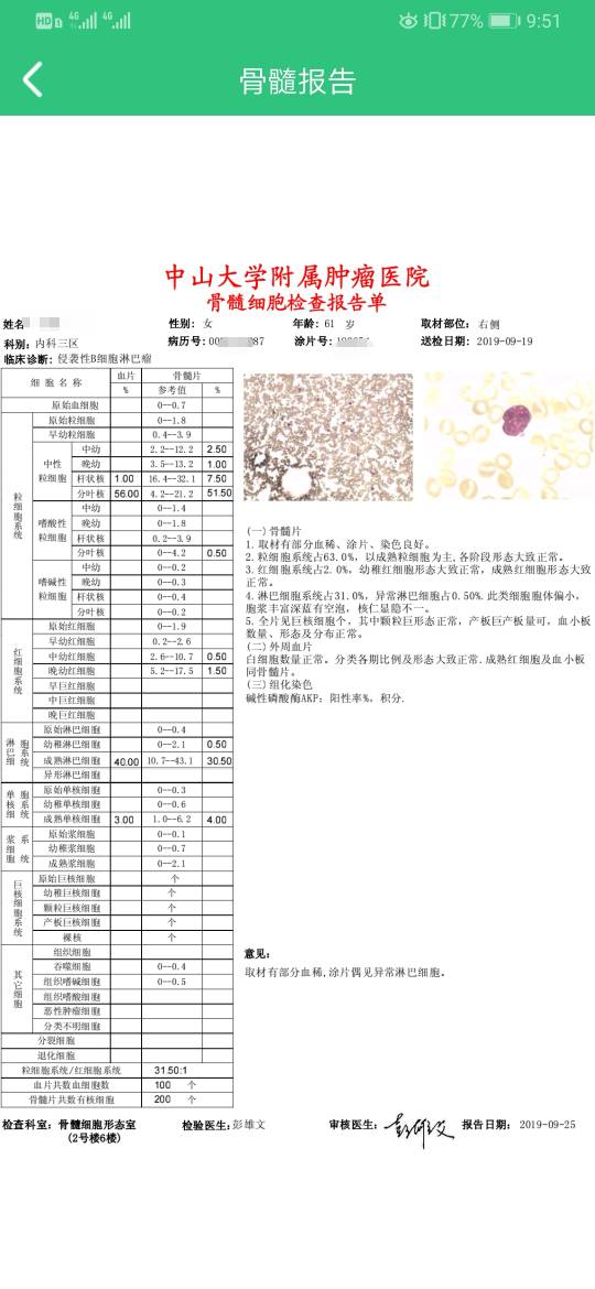 100956fe5ti17cymes1ntq.jpg