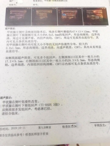 091350ixoouod1x711aqnq.jpg