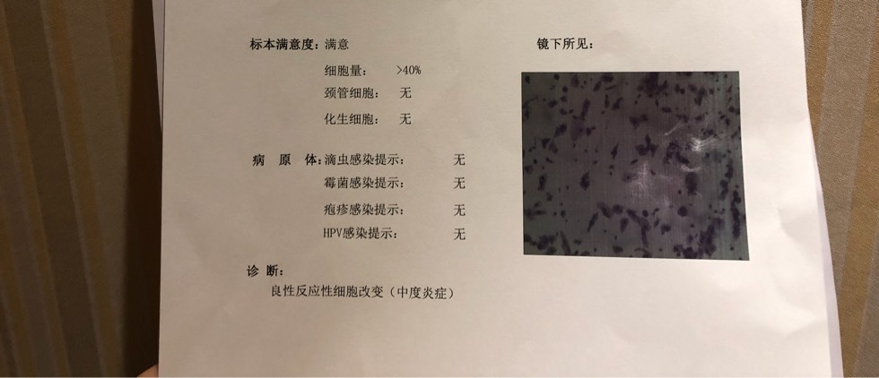 162230nukuk1yu1d11yds8.jpg