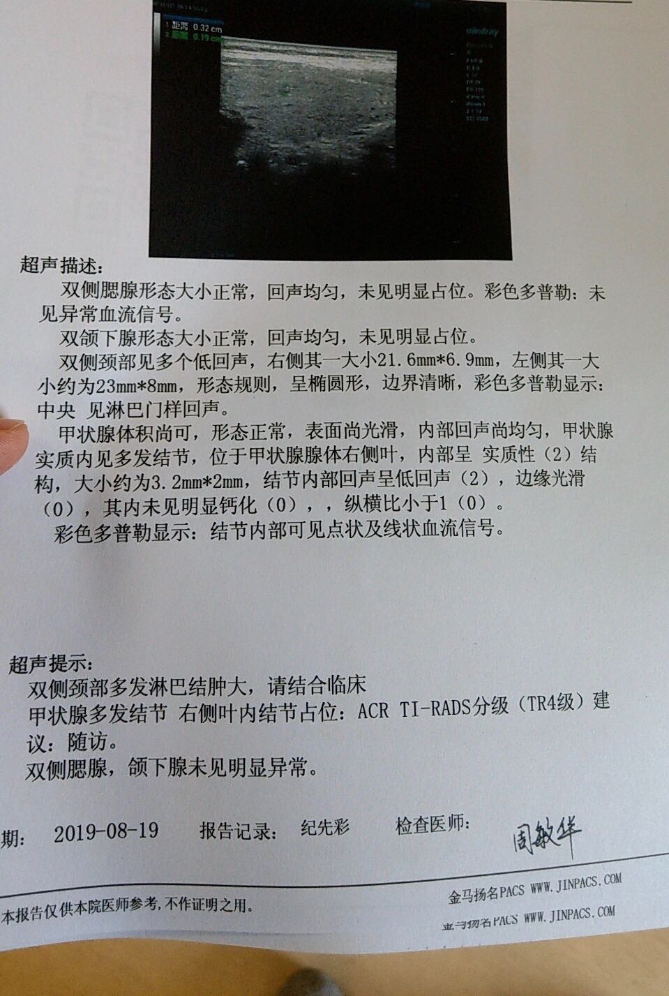 204946lbpeweehq61p3u6v.jpeg