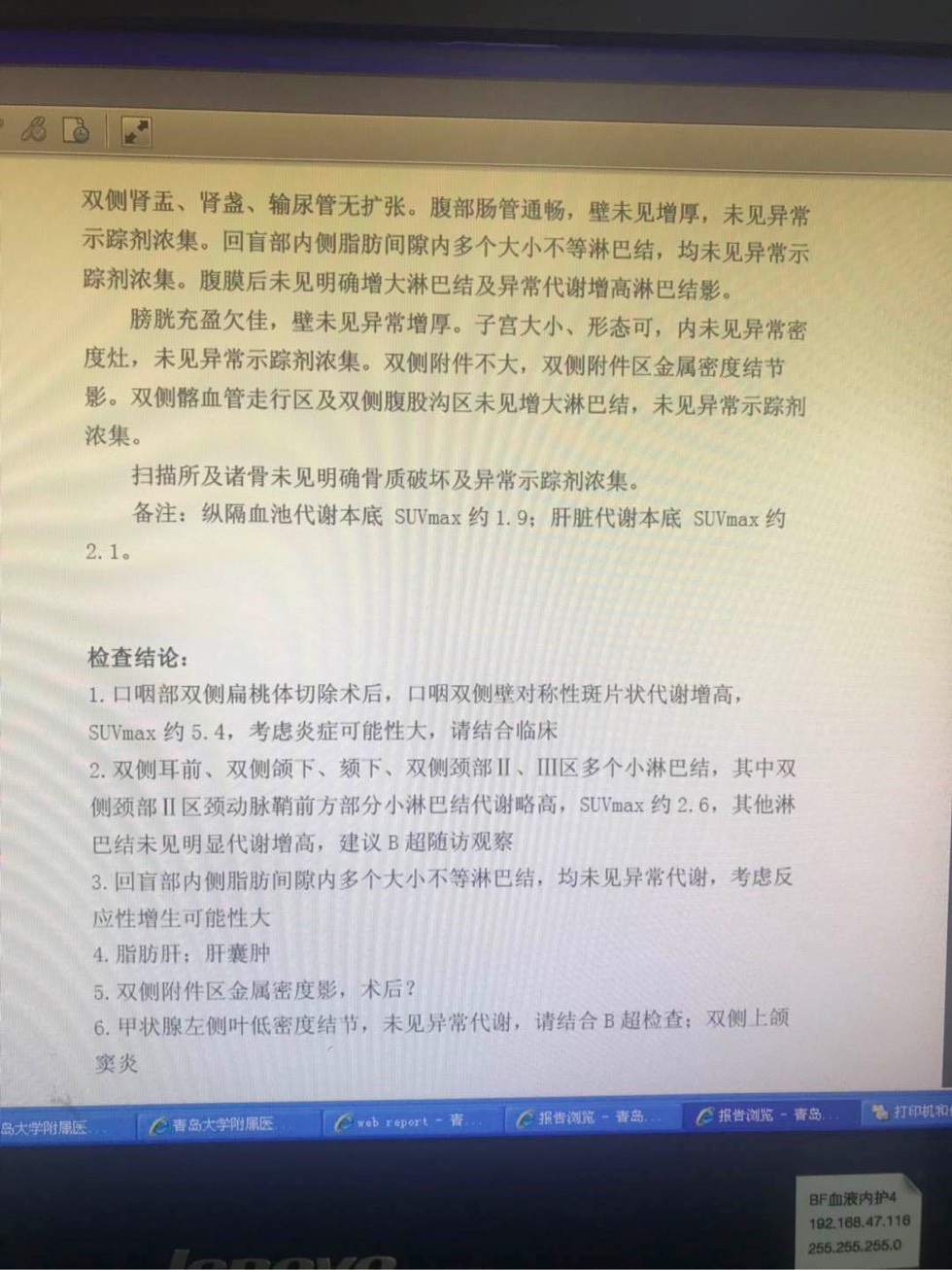 152037fhj2oq12q8qn122v.jpg