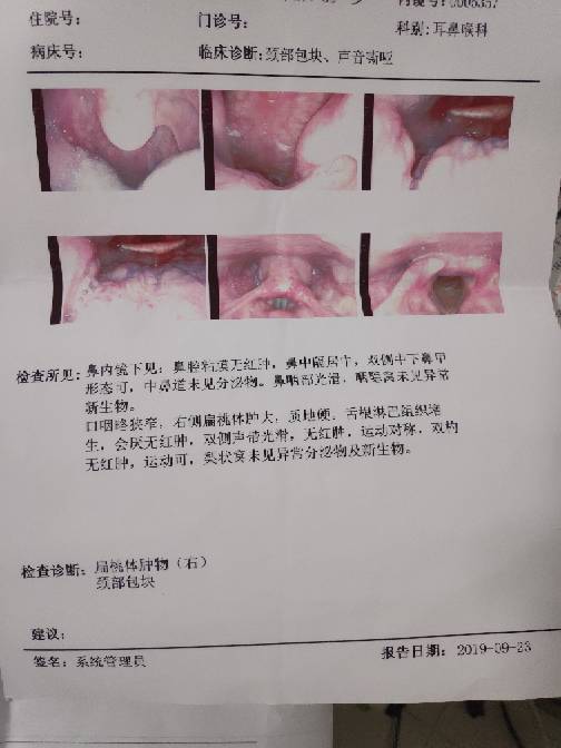 181823t7lmb1bfhmn1s117.jpg