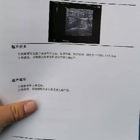 140231h4lk94xxmmnswq6r.jpg