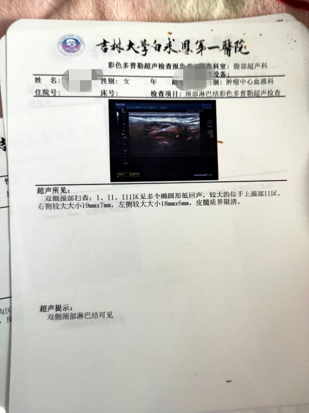 185338xpsr6v2hhe45pa6d.jpg