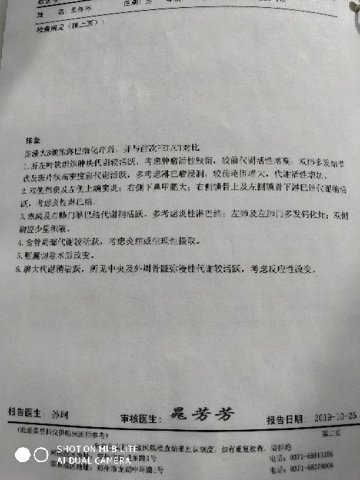 082239nhmtyiks5hmytfpi.jpg