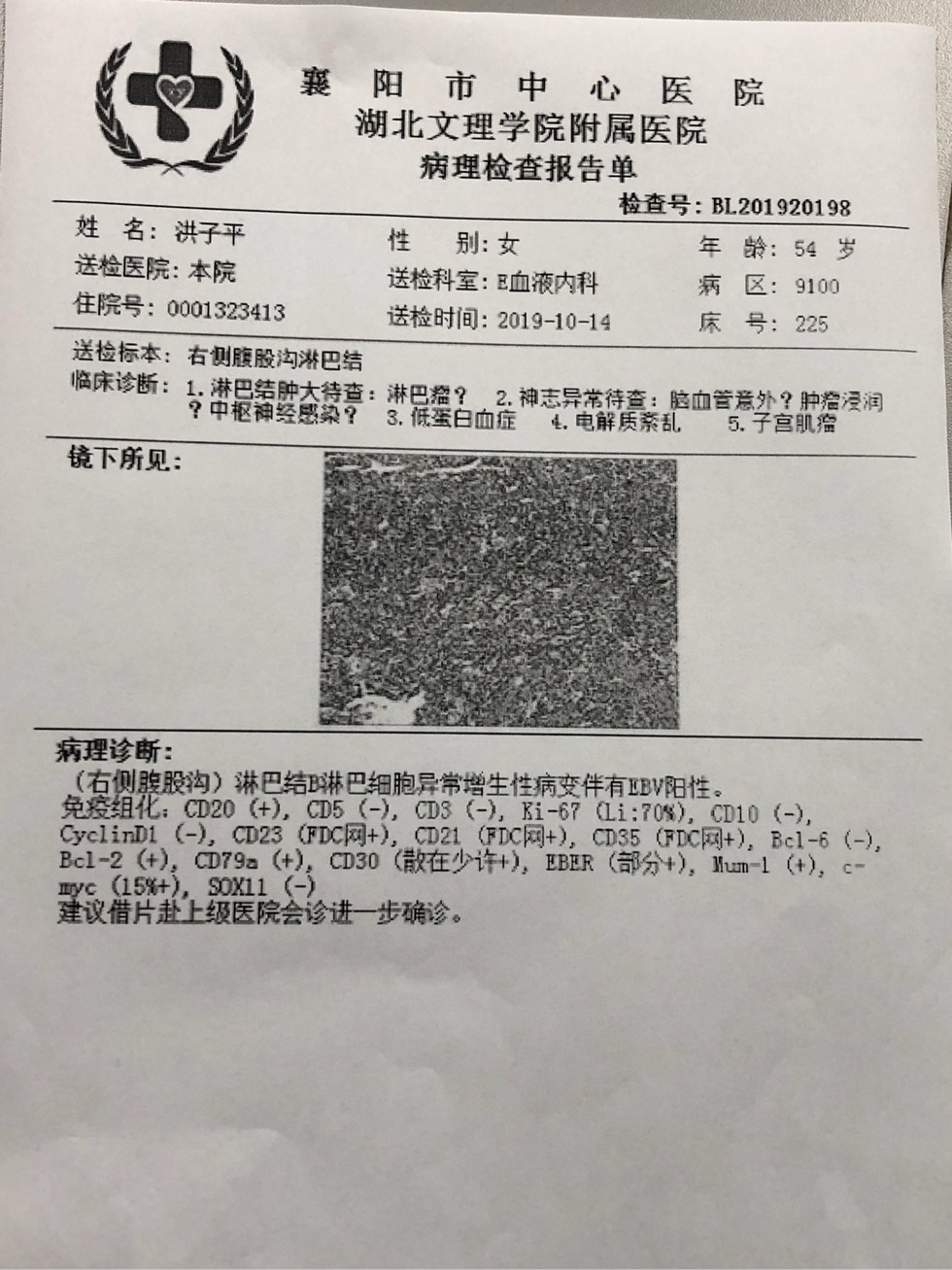 活检报告怎么看图片