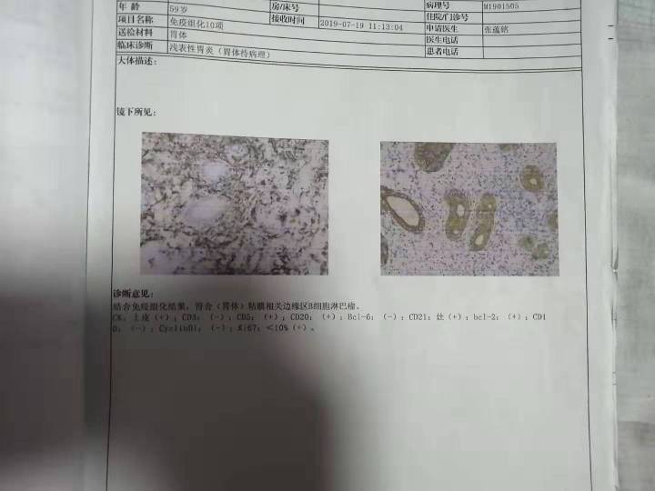 063754aud2ykdn6tc2u3t2.jpg