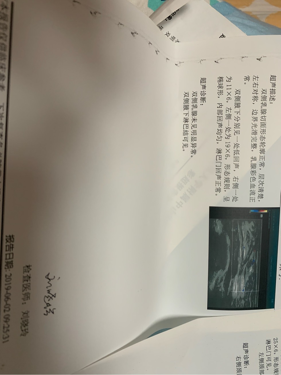 185917idw2bbi28bgigbp6.jpg