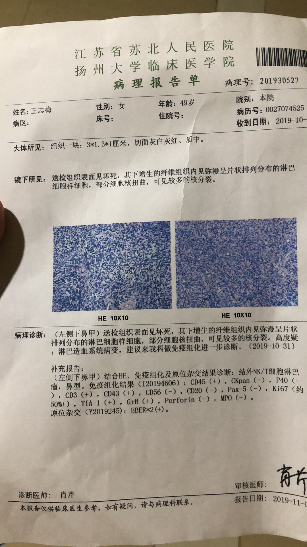 170327ank9905qybbyn99d.jpg