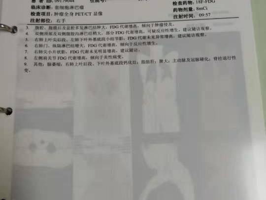 231524pgk16wd7t90kgvd7.jpg