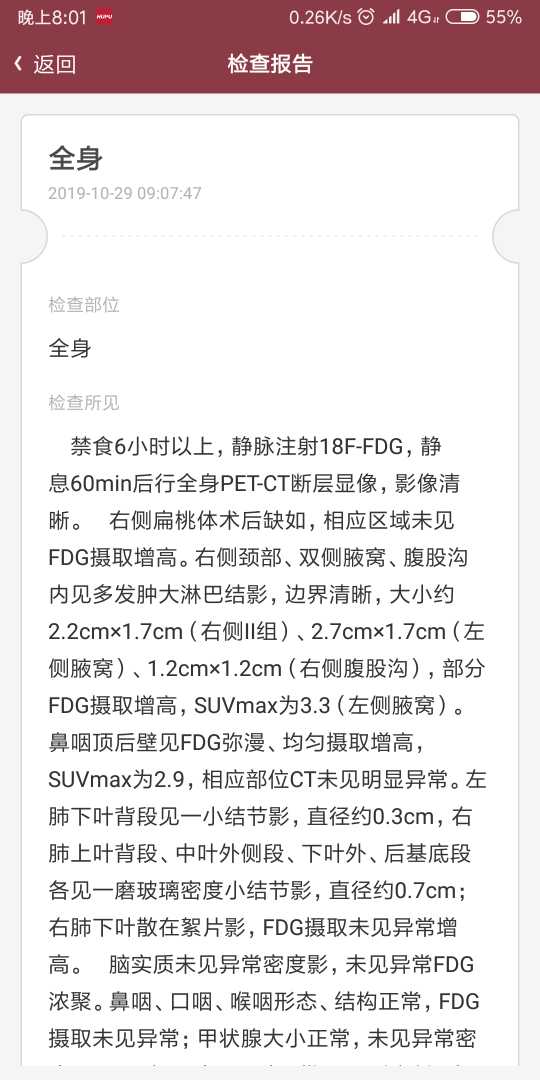 085125jsmmnmng0t718b87.png