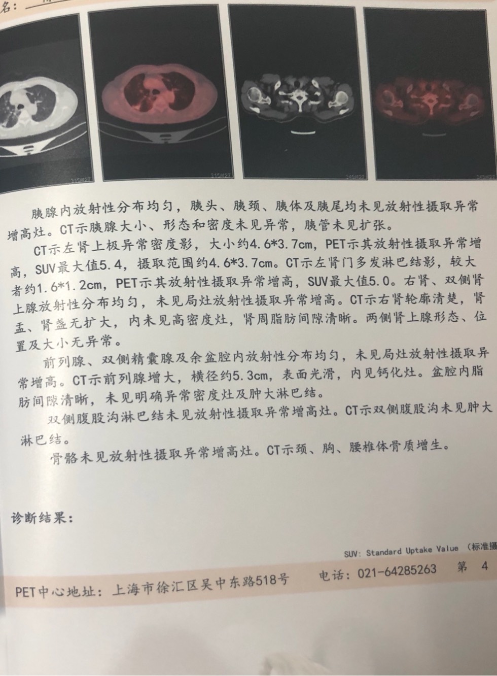 160607xt3mn25m2ll3r60t.jpg