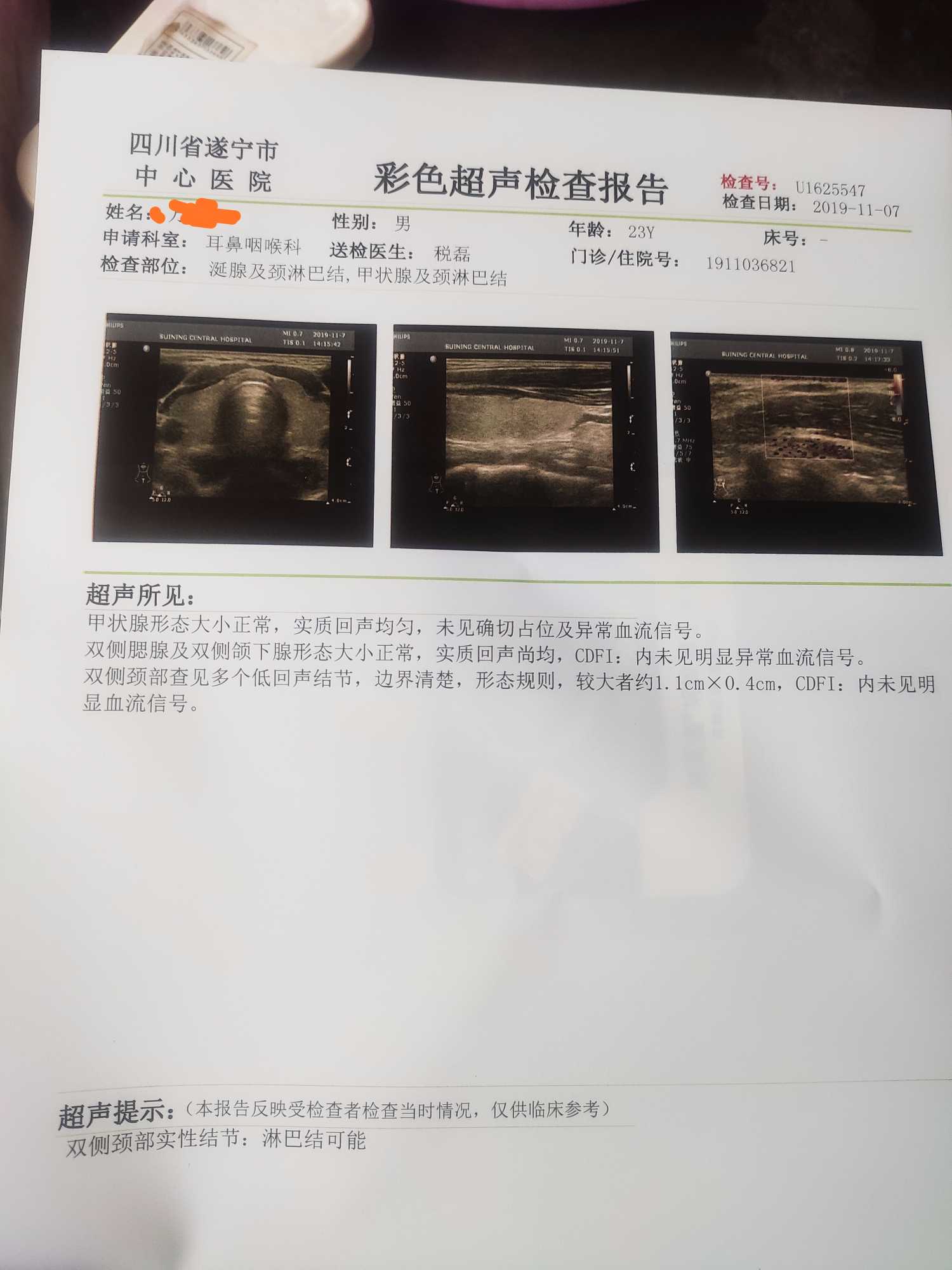 121612h93exei9v41mx333.jpg