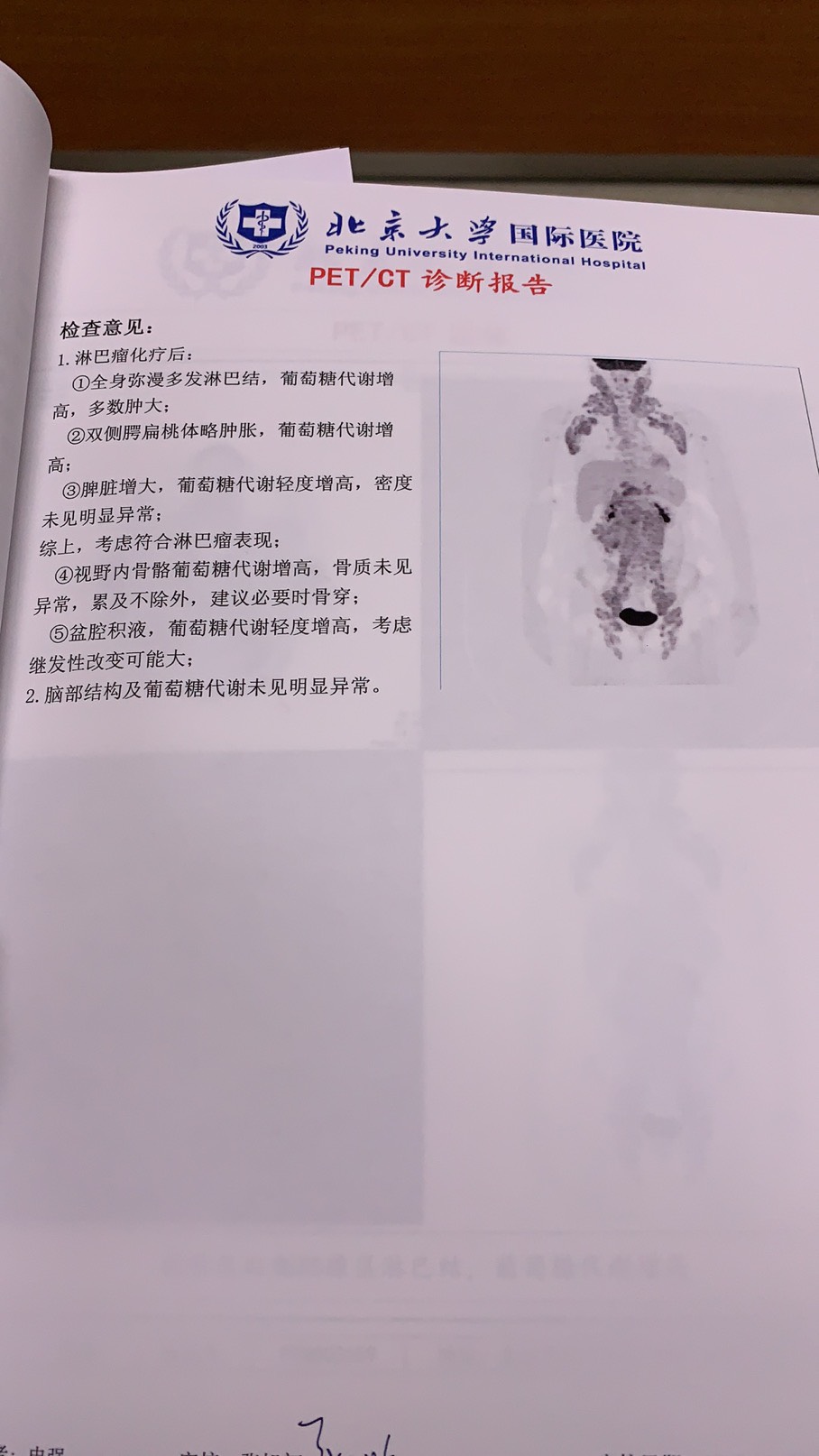 180210jjh8j8phbht9hhs9.jpg