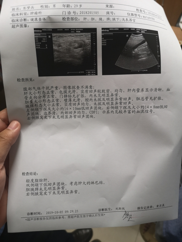 一个月前