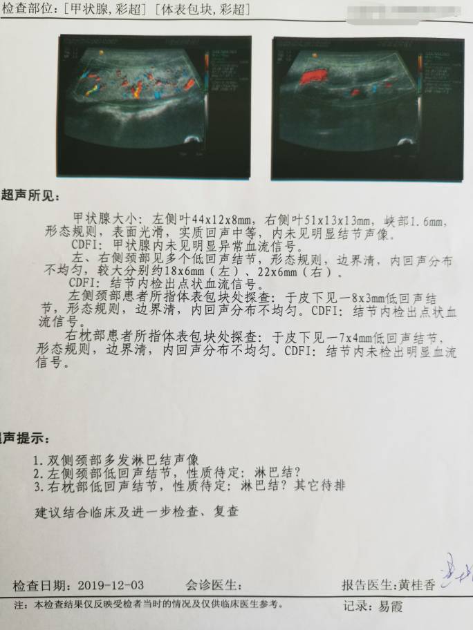 114131s44oow45omztojqp.jpg