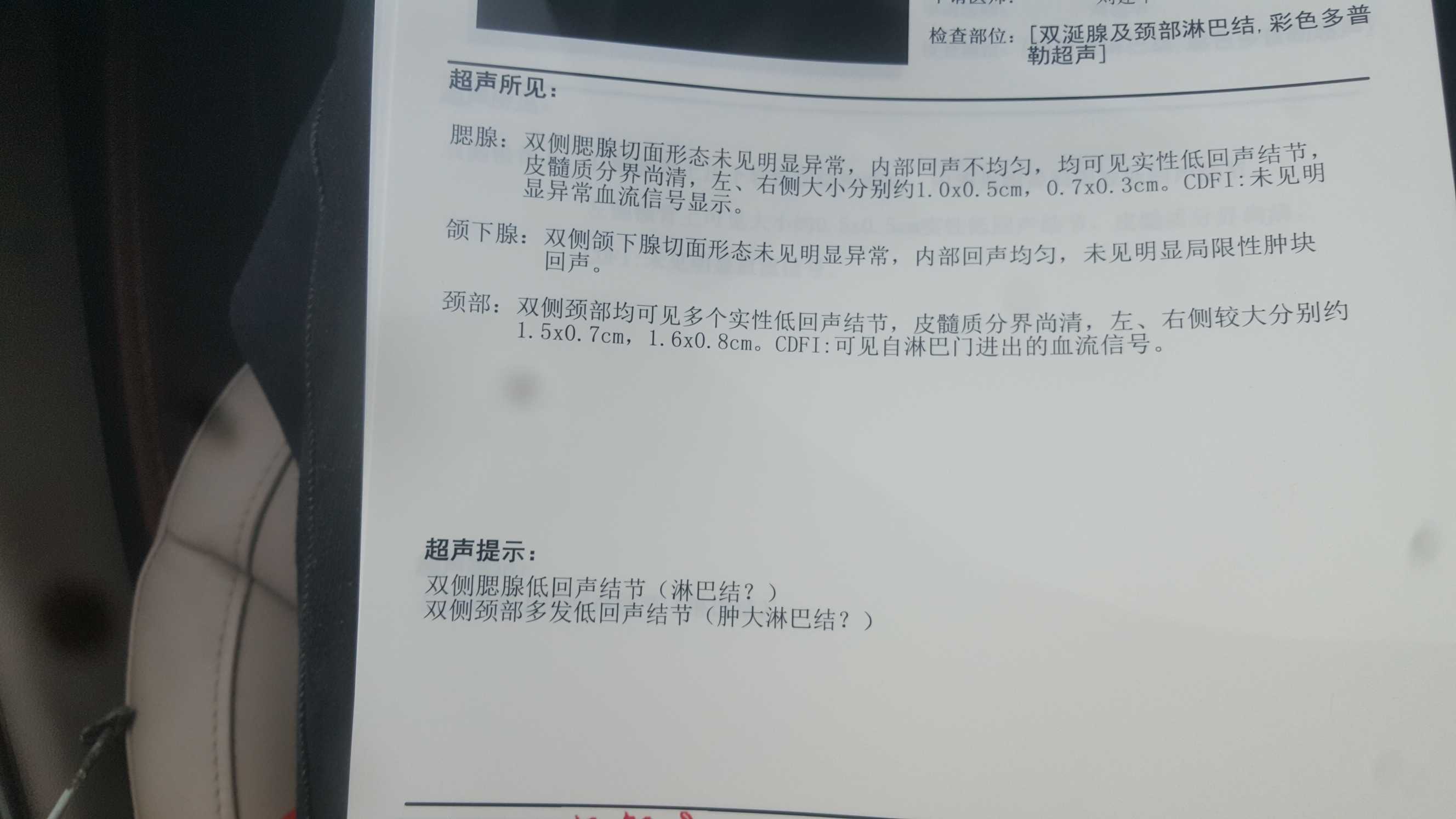 163546kua1mzn8qunwffnq.jpg