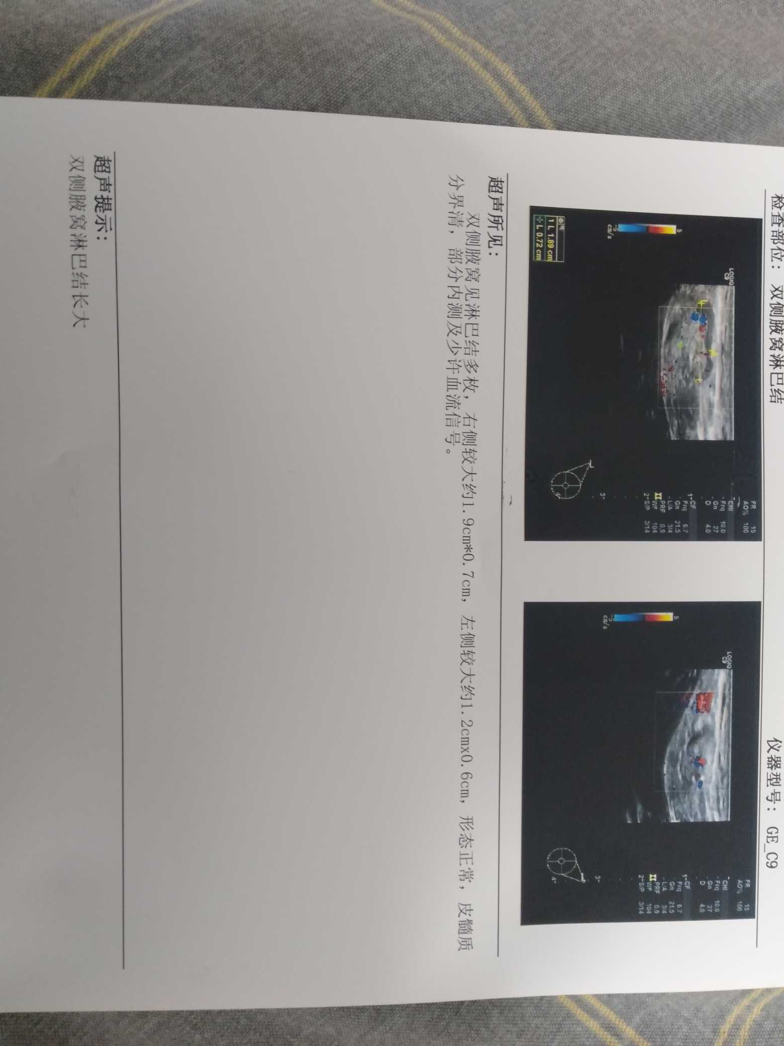 195523ml7irf40c4ici8w1.jpg