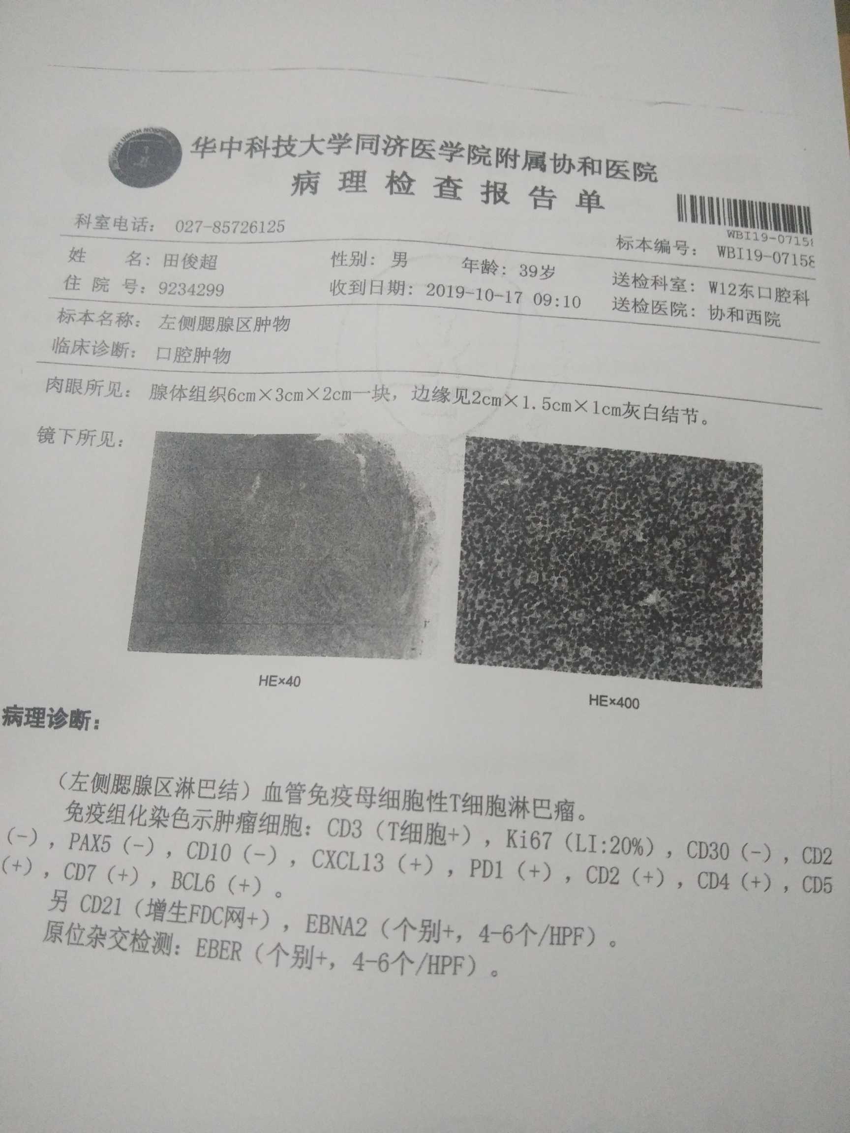 185635agcd884f8bf5zr8b.jpg