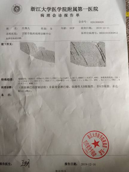 155356qbg2ghhys8mdxixx.jpg