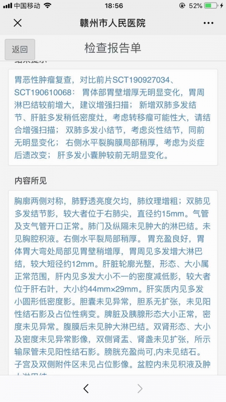 复查CT.jpg