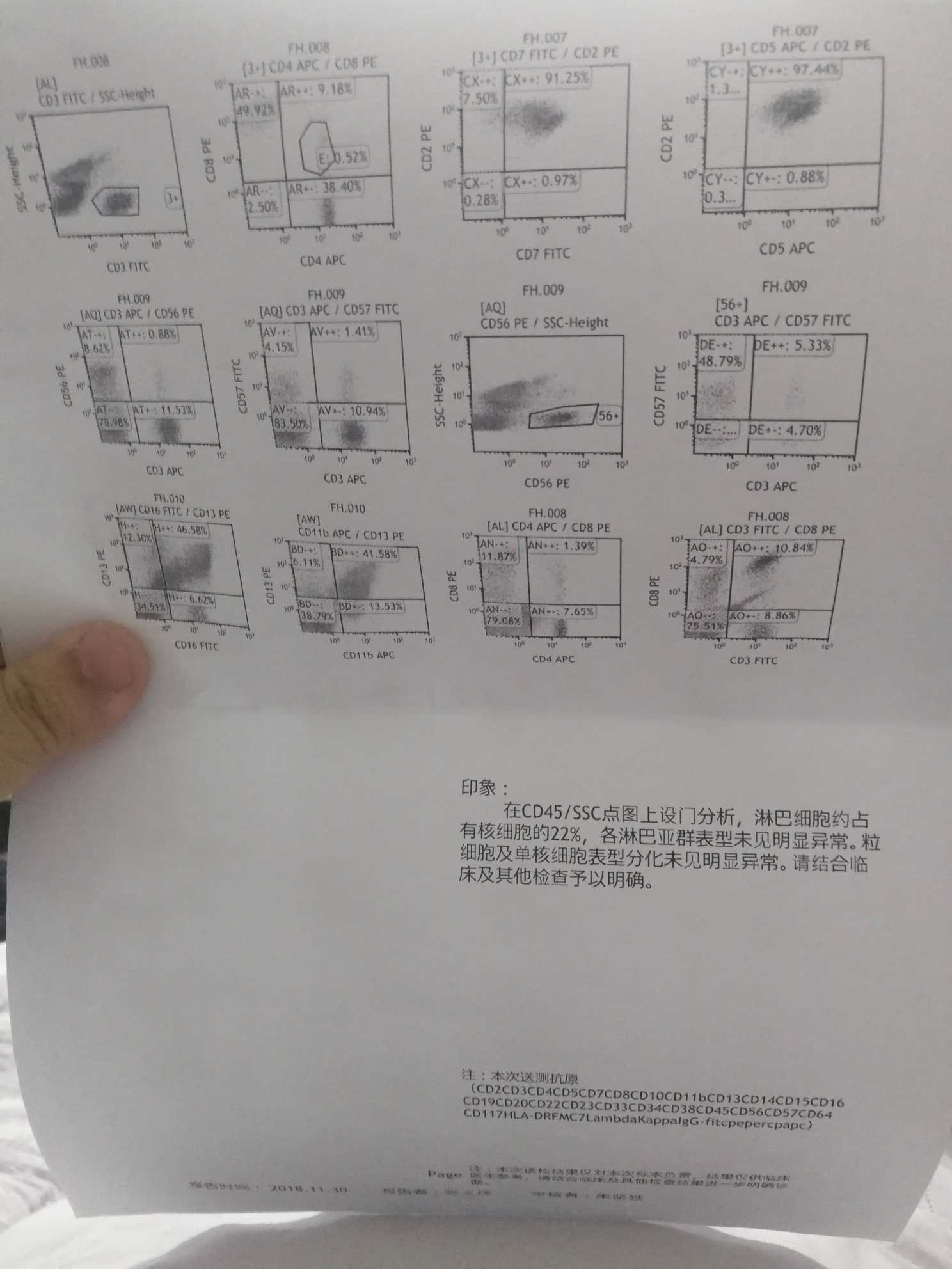 095949pmhkhxzmmmh17xhx.jpg